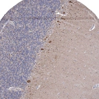 Immunohistochemical staining of human Cerebellum shows moderate cytoplasmic positivity in Purkinje cells.