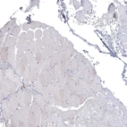 Immunohistochemical staining of human Skeletal muscle shows very weak cytoplasmic positivity in myocytes.