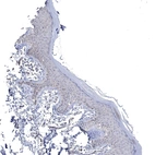 Immunohistochemical staining of human Skin shows very weak cytoplasmic positivity in squamous epithelial cells.