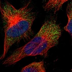Immunofluorescent staining of human cell line U-251 MG shows localization to vesicles.