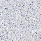 Immunohistochemical staining of human liver shows no positivity in hepatocytes as expected.