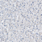 Anti-KRT76 Antibody