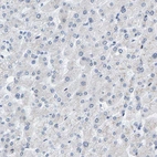 Immunohistochemical staining of human liver shows no positivity in hepatocytes as expected.