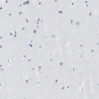 Anti-KRT76 Antibody