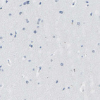 Immunohistochemical staining of human cerebral cortex shows no positivity in neurons as expected.