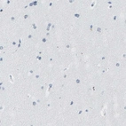 Immunohistochemical staining of human cerebral cortex shows no positivity in neurons as expected.