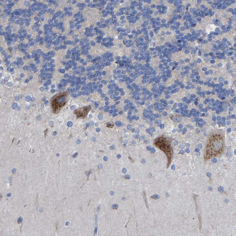 Anti-STRIP2 Antibody