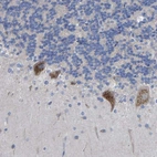 Anti-STRIP2 Antibody