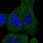 Immunofluorescent staining of human cell line A-431 shows localization to cytosol.