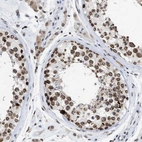 Immunohistochemical staining of human testis shows strong positivity in nuclear membrane in cells in seminiferous ducts.