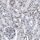 Immunohistochemical staining of human kidney shows strong positivity in nuclear membrane in cells in tubules.