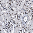 Immunohistochemical staining of human kidney shows strong positivity in nuclear membrane in cells in tubules.