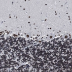 Immunohistochemical staining of human cerebellum shows strong positivity in nuclear membrane in Purkinje cells.