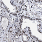 Immunohistochemical staining of human prostate shows strong positivity in nuclear membrane in glandular cells.