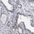 Immunohistochemical staining of human prostate shows strong positivity in nuclear membrane in glandular cells.