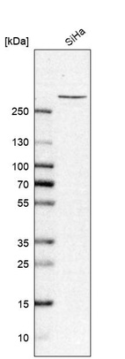 Western blot analysis in human cell line SiHa.