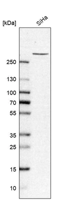Western blot analysis in human cell line SiHa.