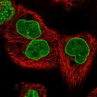 Immunofluorescent staining of human cell line A-431 shows localization to nuclear membrane.