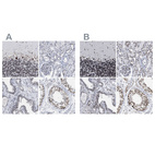 Anti-TPR Antibody