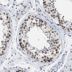 Immunohistochemical staining of human testis shows moderate positivity in nuclear membrane in cells in seminiferous ducts.