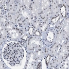 Immunohistochemical staining of human kidney shows moderate positivity in nuclear membrane in cells in tubules.