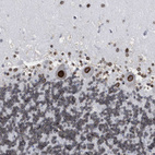 Immunohistochemical staining of human cerebellum shows strong positivity in nuclear membrane in Purkinje cells.