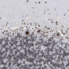 Anti-TPR Antibody