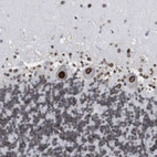 Immunohistochemical staining of human cerebellum shows strong positivity in nuclear membrane in Purkinje cells.