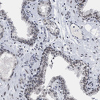 Immunohistochemical staining of human prostate shows moderate positivity in nuclear membrane in glandular cells.