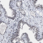 Immunohistochemical staining of human prostate shows moderate positivity in nuclear membrane in glandular cells.