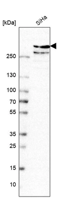 Western blot analysis in human cell line SiHa.