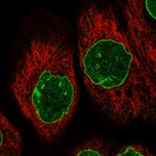 Immunofluorescent staining of human cell line A-431 shows localization to nuclear membrane.