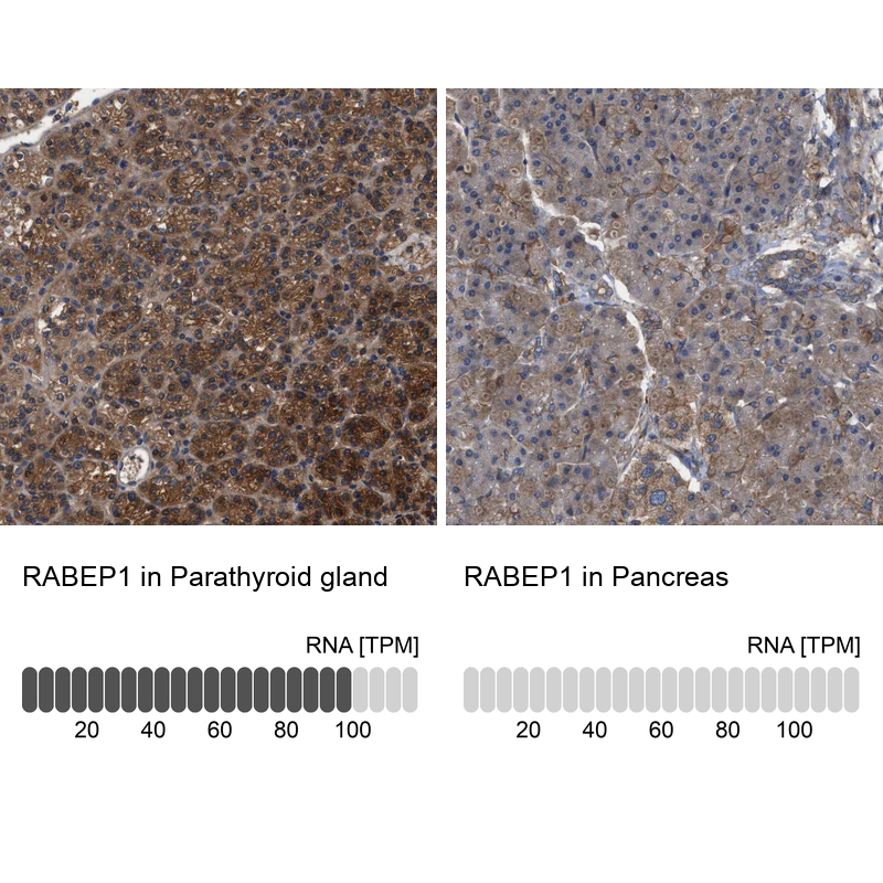 Anti-RABEP1 Antibody