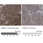 Anti-RABEP1 Antibody
