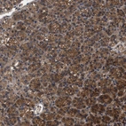 Immunohistochemical staining of human parathyroid gland shows high expression.