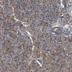 Immunohistochemical staining of human pancreas shows low expression as expected.