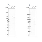 Western blot analysis using Anti-RABEP1 antibody HPA019669 (A) shows similar pattern to independent antibody HPA024235 (B).