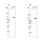 Western blot analysis using Anti-RABEP1 antibody HPA019669 (A) shows similar pattern to independent antibody HPA024235 (B).
