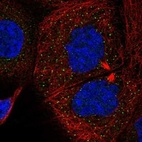 Anti-SMURF1 Antibody