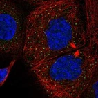 Anti-SMURF1 Antibody