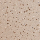 Anti-NPAS2 Antibody