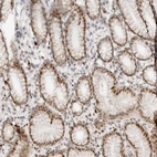 Immunohistochemical staining of human stomach shows moderate nuclear positivity in glandular cells.