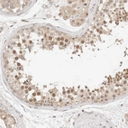 Immunohistochemical staining of human testis shows moderate nuclear positivity in cells in seminiferous ducts.