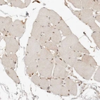 Immunohistochemical staining of human skeletal muscle shows weak nuclear positivity in myocytes.
