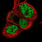 Immunofluorescent staining of human cell line A-431 shows localization to nucleoplasm.