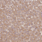 Anti-RNF128 Antibody