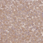 Anti-RNF128 Antibody