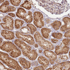 Immunohistochemical staining of human kidney shows strong cytoplasmic positivity in cells in tubules.