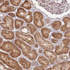 Immunohistochemical staining of human kidney shows strong cytoplasmic positivity in cells in tubules.