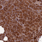 Immunohistochemical staining of human pancreas shows strong cytoplasmic positivity in exocrine glandular cells.